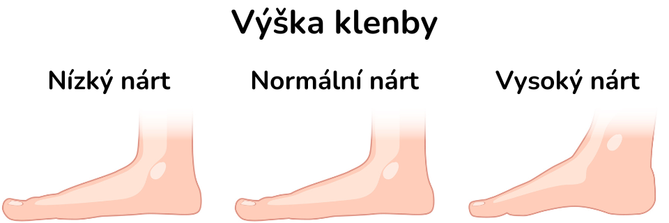 Typy chodidel - výška nártu 2 (2)